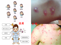 《第二节 传染病及其预防》PPT课件6-济南版生物七年级下册