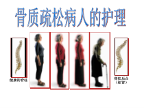 【新整理】骨质疏松病人的护理ppt课件