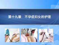 妇产科护理学不孕症妇女的护理PPT