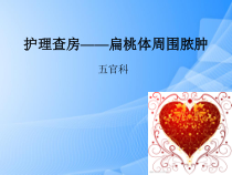 护理查房——扁桃体周围脓肿PPT