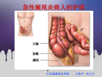 急性阑尾炎病人的护理精课件