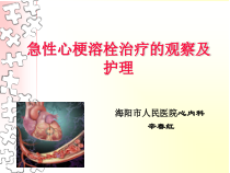 急性心梗溶栓治疗的观察及护理课件