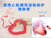 急性心肌梗死的溶栓护理查房课件