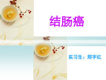 结肠癌护理查房PPT课件