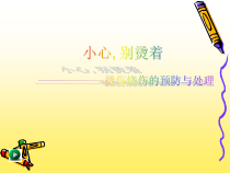 健康教育【武汉版】四年级第十七课《小心，别烫着3》PPT课件