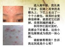 健康教育【武汉版】六年级第二十三课《痤疮的发生与预防》PPT课件
