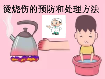 体育与健康【通用版】五年级《烧烫伤的预防和处理方法》PPT课件(共18页)