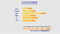 消化道吻合手术对缝针缝线的选择课件