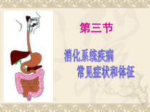 消化系统常见症状与体征-课件