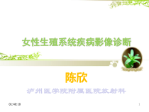 女性生殖系统影像诊断课件