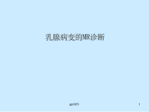 乳腺MRI诊断课件