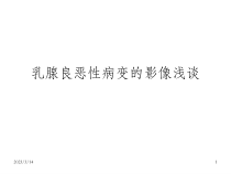 乳腺分区及影像学表现课件