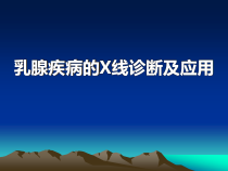 乳腺疾病的X线诊断及应用课件