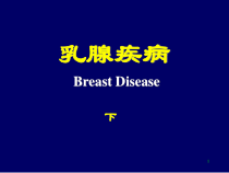 乳腺疾病下课件