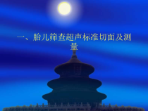 胎儿超声标准切面课件