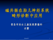 胎儿磁共振诊断课件