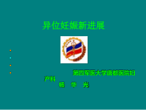 异位妊娠新进展-杨华光课件
