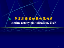 子宫肌瘤的动脉栓塞治疗课件