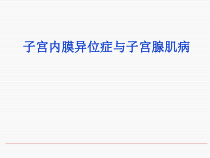 子宫内膜异位症和腺肌症课件