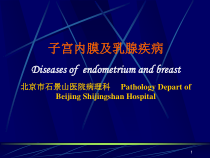 子宫内膜和乳腺疾病课件