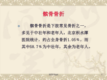 髌骨骨折-医学课件