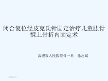 闭合复位经皮克氏针固定治疗儿童肱骨髁上骨折内固定术课件
