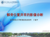 髌骨位置异常的影像诊断-丁建平课件