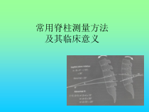 常用脊柱测量技巧及其临床意义课件