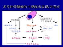 多发性骨髓瘤的分层治疗课件