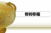 多发性肿瘤骨转移诊断与治疗课件