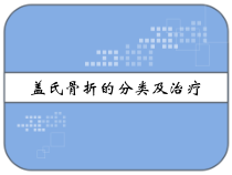 盖氏骨折的分类及治疗-课件