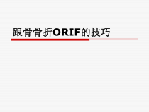 跟骨手术治疗技巧-课件