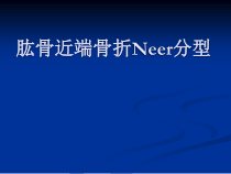 肱骨近端骨折Neer分型及治疗课件