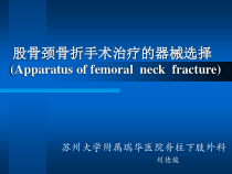 股骨颈骨折手术治疗器械选择课件