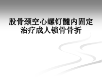 股骨颈空心螺钉髓内固定治疗成人锁骨骨折精选课件