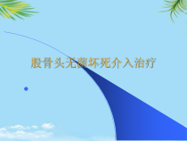 股骨头无菌坏死介入治疗课件