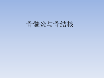 骨骼异常影像学表现医学课件