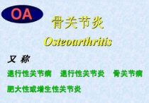 骨关节炎的治疗公开课课件