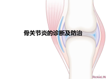 骨关节炎诊治患者教育参考课件