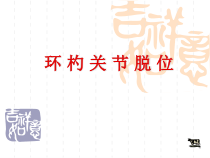 环杓关节脱位课件