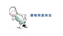 腰椎间盘突出课件