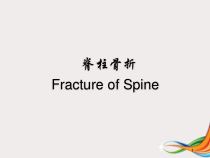 医学课件脊柱骨折与脊髓损伤