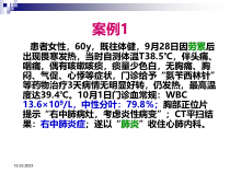 从案例分析看药师的抗感染思维36张课件
