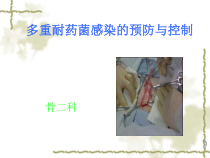多重耐药菌感染的预防与控制课件_2