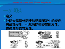 妇科病症和联合用药知识课件