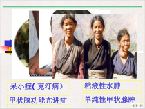 甲状腺及抗甲状腺素药浅定实用版课件