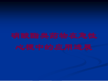 硝酸酯类药物在急性心梗中的应用进展培训课件
