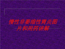 慢性非萎缩性胃炎图片和用药讲解培训课件