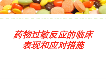 药物过敏反应的临床表现和应对措施培训课件