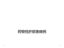 药物性肝损害病例课件